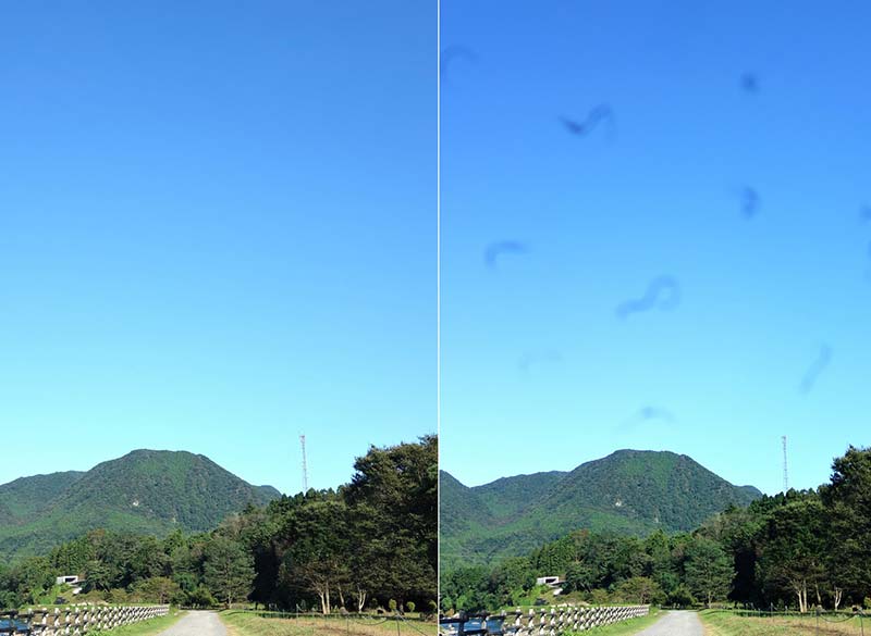 飛蚊症